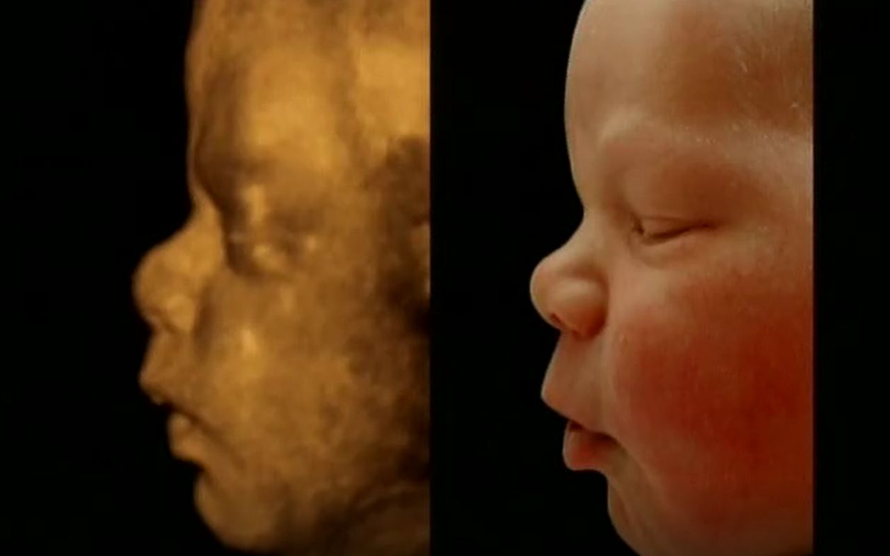 生命之旅-人体内部探险：从接吻到婴儿出生-纪录片-高清