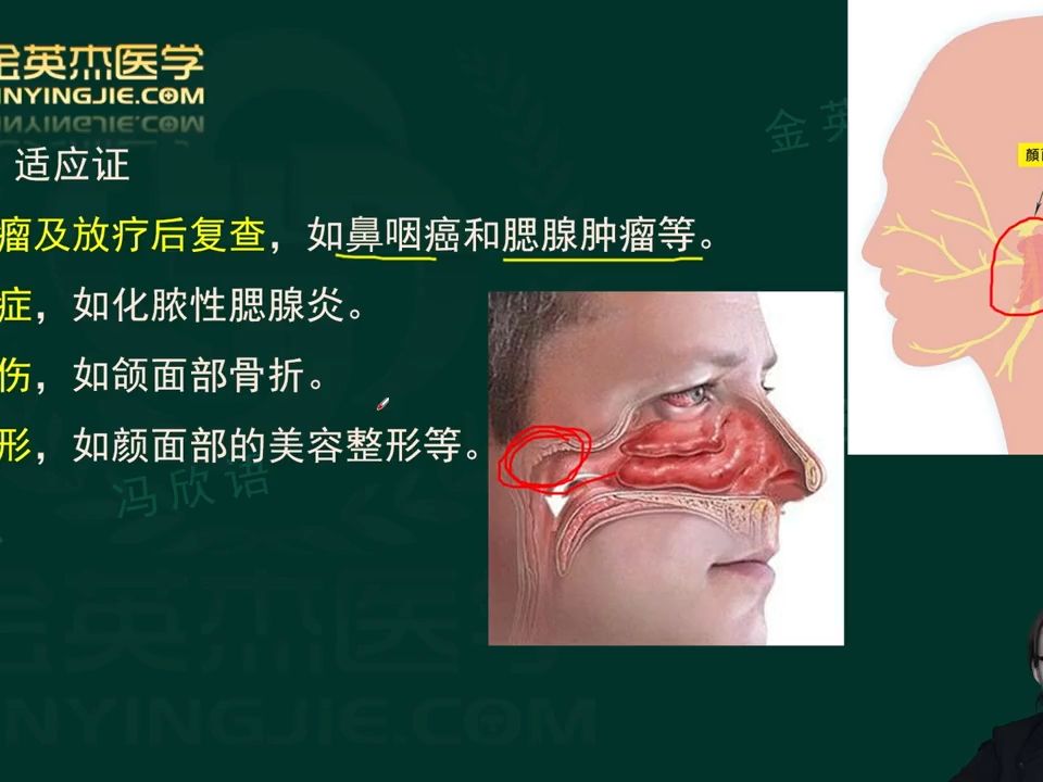 2025年放射医学技士、师、中级考试第4篇 专业实践能力-第14章（2）