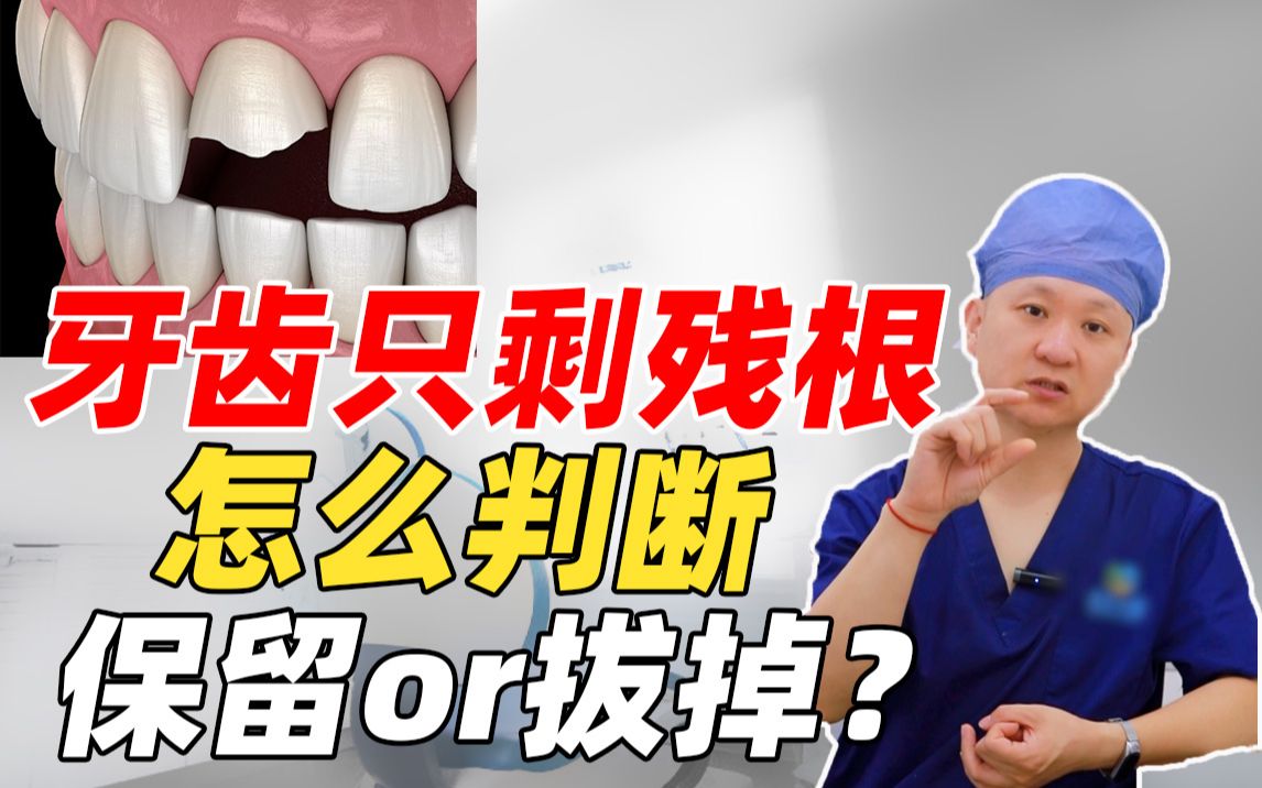 牙齿只剩残根，怎么判断该保留还是拔掉？一次讲清楚！