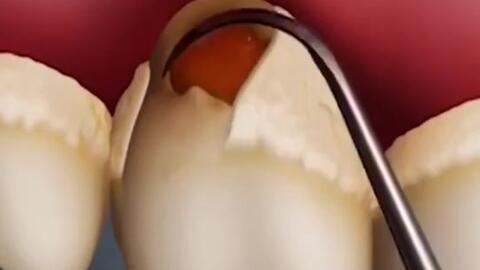 51fd7199c9407544e09ff43a218cced5cdbba2be.jpg@480w_270h_1c