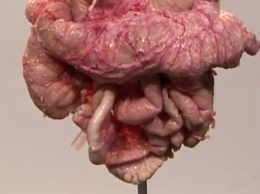 视频中将向你展示人体完整的内脏器官