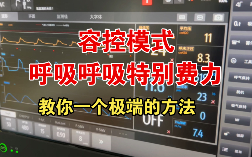 容控模式患者呼吸特别费力，教你一个极端的处理方法，亲测有效