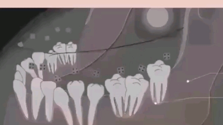 牙齿矫正会引起牙齿松动吗？来看看牙齿矫正原理