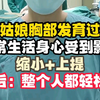 小姑娘胸部发育过大不堪重负，日常生活身心受到很大的影响，缩小+上提，术后整个人都轻松多了