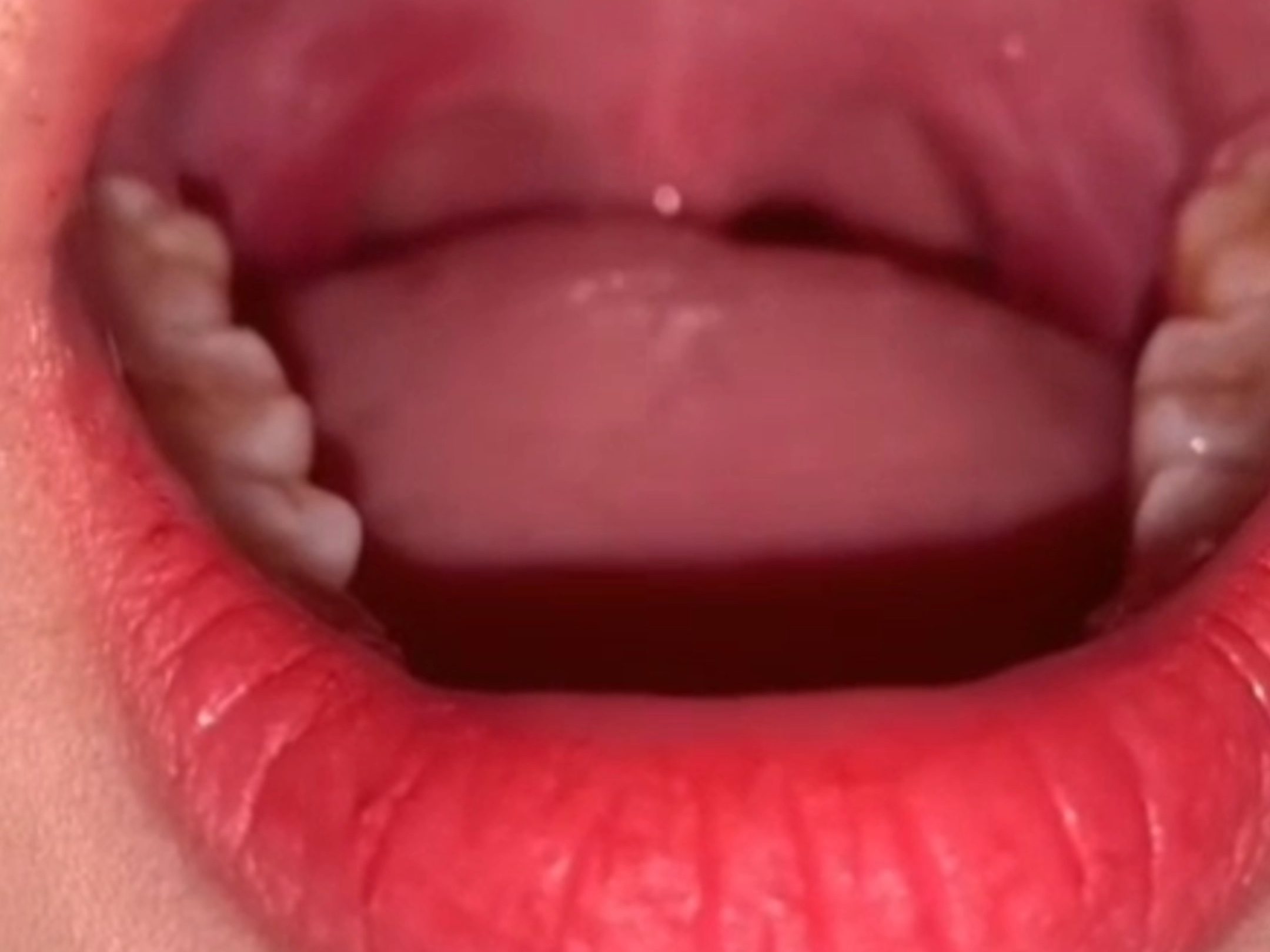 【口腔护理0】请老板放心做吧。