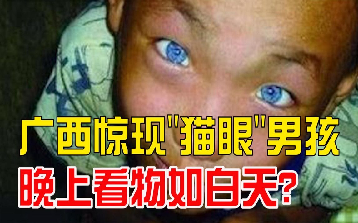 广西南乡镇惊现猫眼男孩竟有夜视能力晚上看物如白天