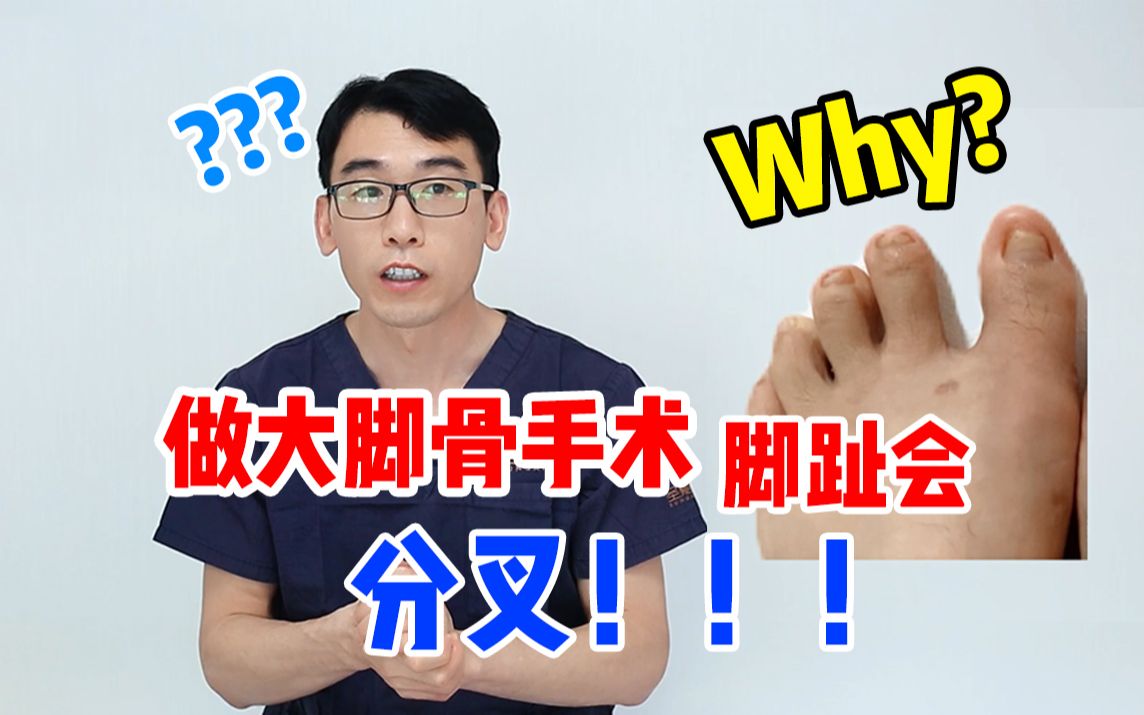 【苏敬达】科普:做完大脚骨手术为什么会脚趾分叉?多久能重新闭合?