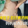 儿子睡觉手老往裤裆伸，妈妈检查白斑溢出！#白癜风