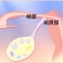 北京卫人中医医院专家科普：输卵管伞端上举导致女性不孕！