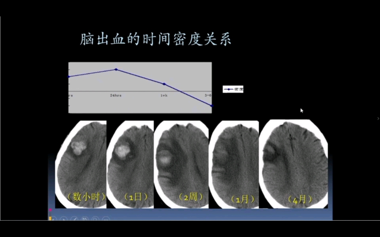 神经系统影像基本知识