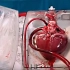 3D打印人造的心脏，像真心脏一样，能跳动3000多次，心脏病人有救了