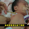 胎儿查出先天性心脏病，医生建议生下，不想刚生下来家长就后悔了