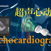 超声心动图||Echocardiogram