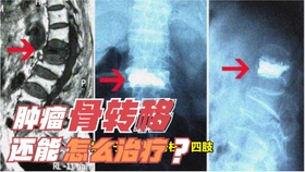 5ab7d20966803e73d47dc7af1d86e1bd5e07fb98.jpg@280w_158h_1c_100q.jpg