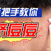 什么样的痘痘能挤？皮肤科医生教你正确挤痘方式