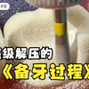你知道什么是备牙吗？牙体预备是牙科修复中非常重要的一个步骤，一起来看全过程吧
