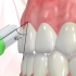 刷牙、电动牙刷、牙线使用教程，带你开启正确的牙齿清洁姿势