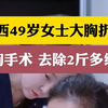 江西49岁女士大胸折磨多年，缩胸手术去除2斤多组织