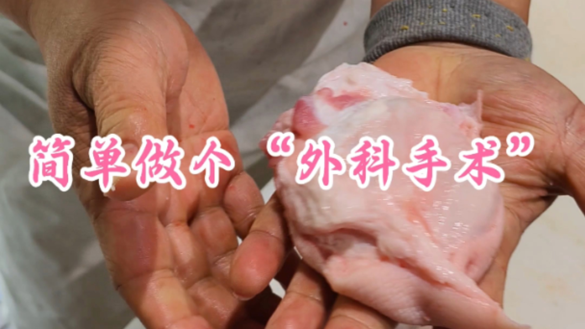 简单做个“外科手术”