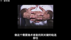 5d457418bdd1d2b01dd0709e149d7b33276edf81.jpg@280w_158h_1c_100q.jpg