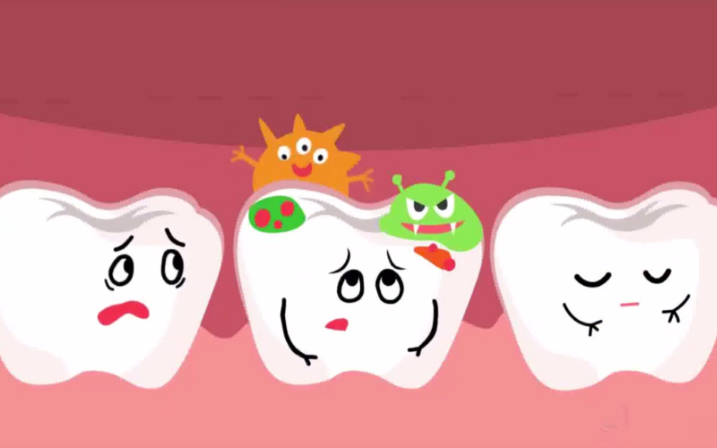 蛀牙是怎么形成的❓蛀牙又有哪些危害❓