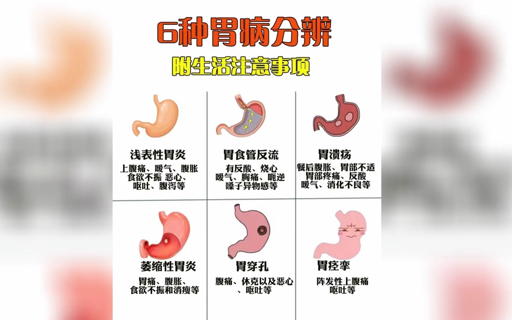 6种胃病分辨