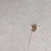 为什么会有阴虱？#阴虱 #虱子 #虱子卵