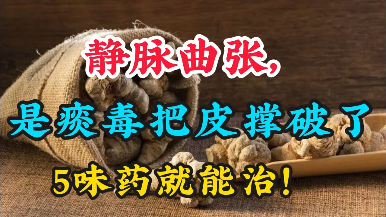 一位老中医说：“哪有什么静脉曲张，不过是痰毒把皮撑破了。”5味药，治好患者的静脉曲张后，我才明白：世间并无庸医，只是贪心作祟！