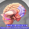 【TED科普】抑郁症怎样影响大脑？该怎么治疗