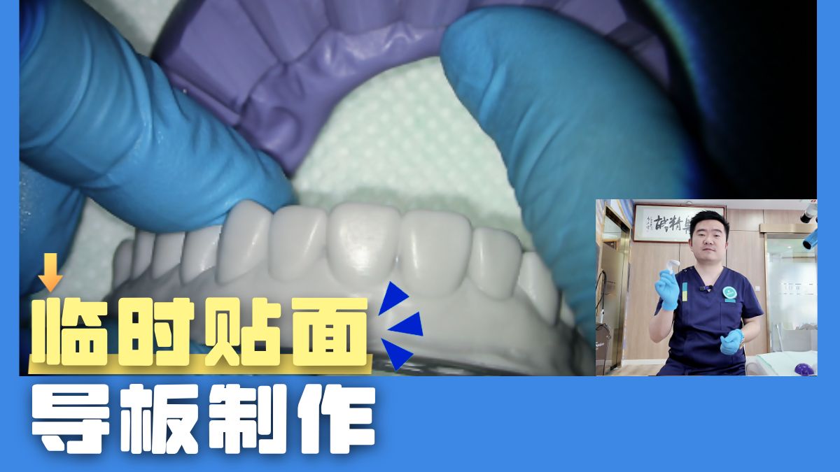 口腔人快码：一条视频掌握临时贴面硅橡胶导板制作