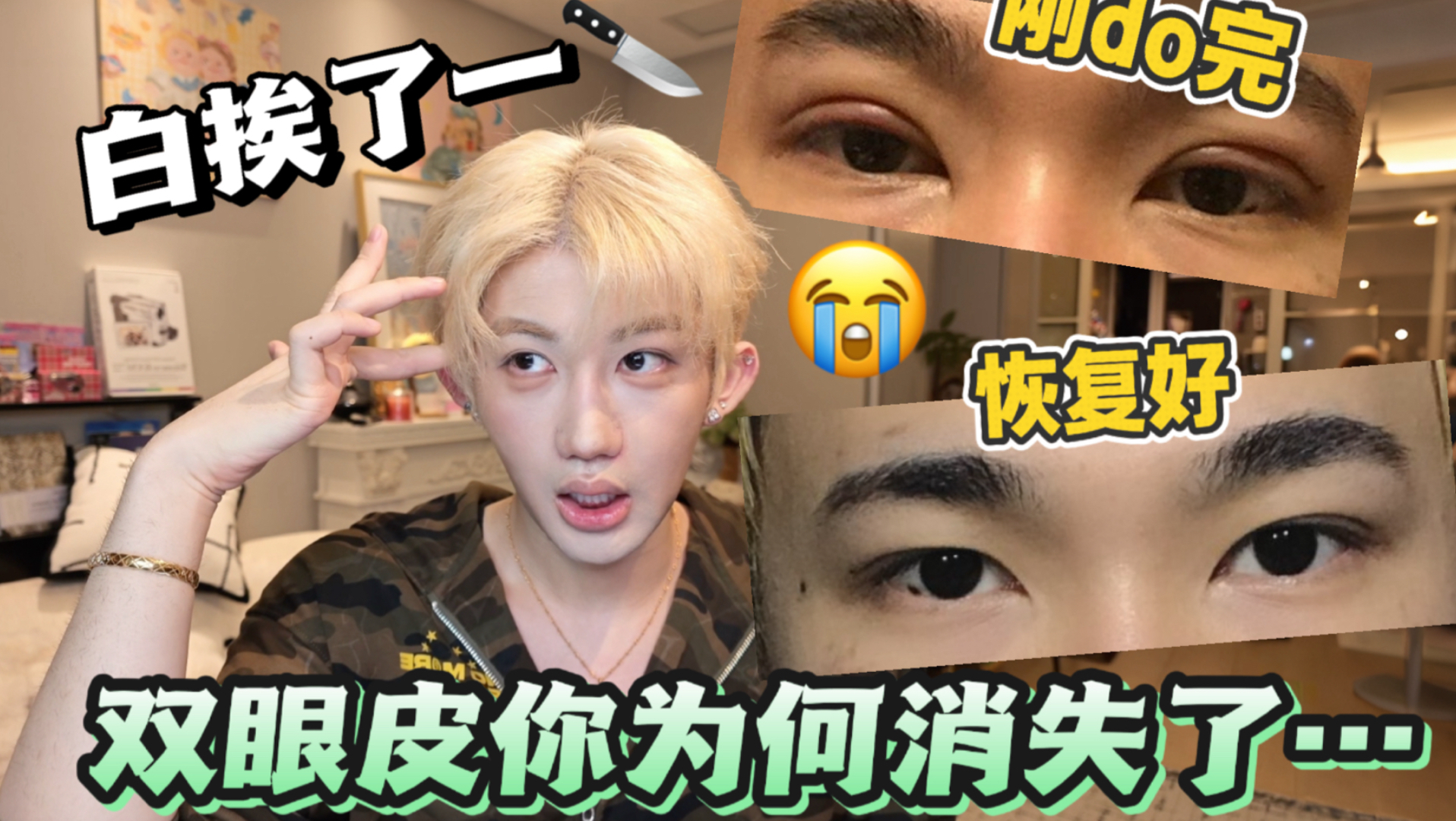 双眼皮做完还能消失…白白挨了一刀几乎没变化…今天要解决我心头的疑惑！