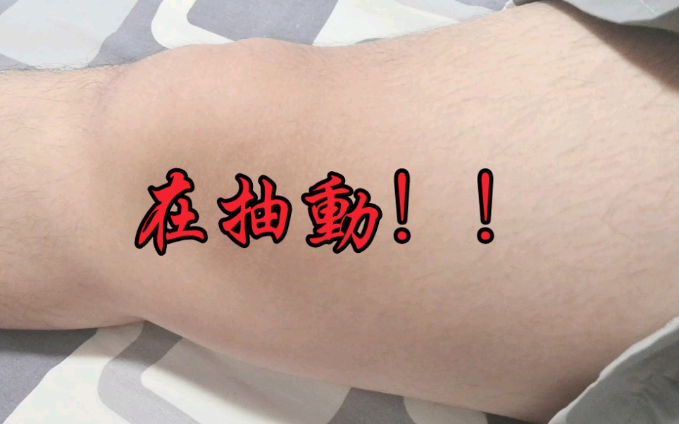 【爛爛爛爛泥】緊急掏出手機拍攝下我的大腿肌肉抽搐16秒。（用繁體字也不一定台灣人啊。。）
