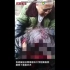 四川泸县一老人被狗袭击，整张脸没了，画面极度血腥（已打码）