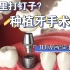 【口腔视频】种植牙手术-3D动画演示