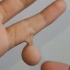 畸形的第六根手指