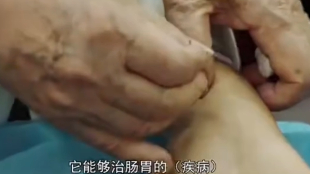 郭老的穴位实操演示