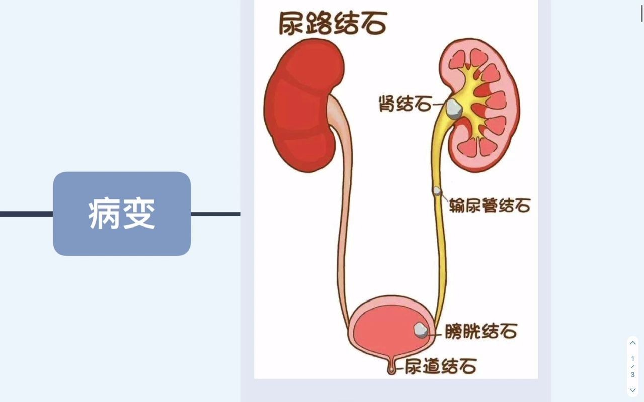 猫膀胱结石