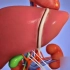 肝移植的手术过程，3D演示。
