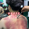 刮完痧后背还得做个惊心动魄酥麻的跳三刀，小哥太会享受了