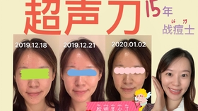 6cb0d24239965115a2753f215660069ed204553a.jpg@280w_158h_1c_100q.jpg