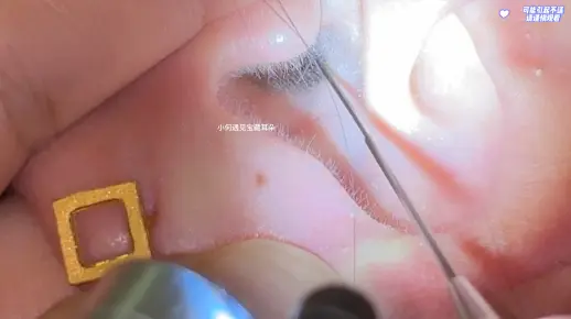 一年前因为怀宝宝而存下来到现在都没取的这一堆耳皮