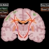 大脑内部结构（联络纤维、连合纤维、投射纤维、基底核）