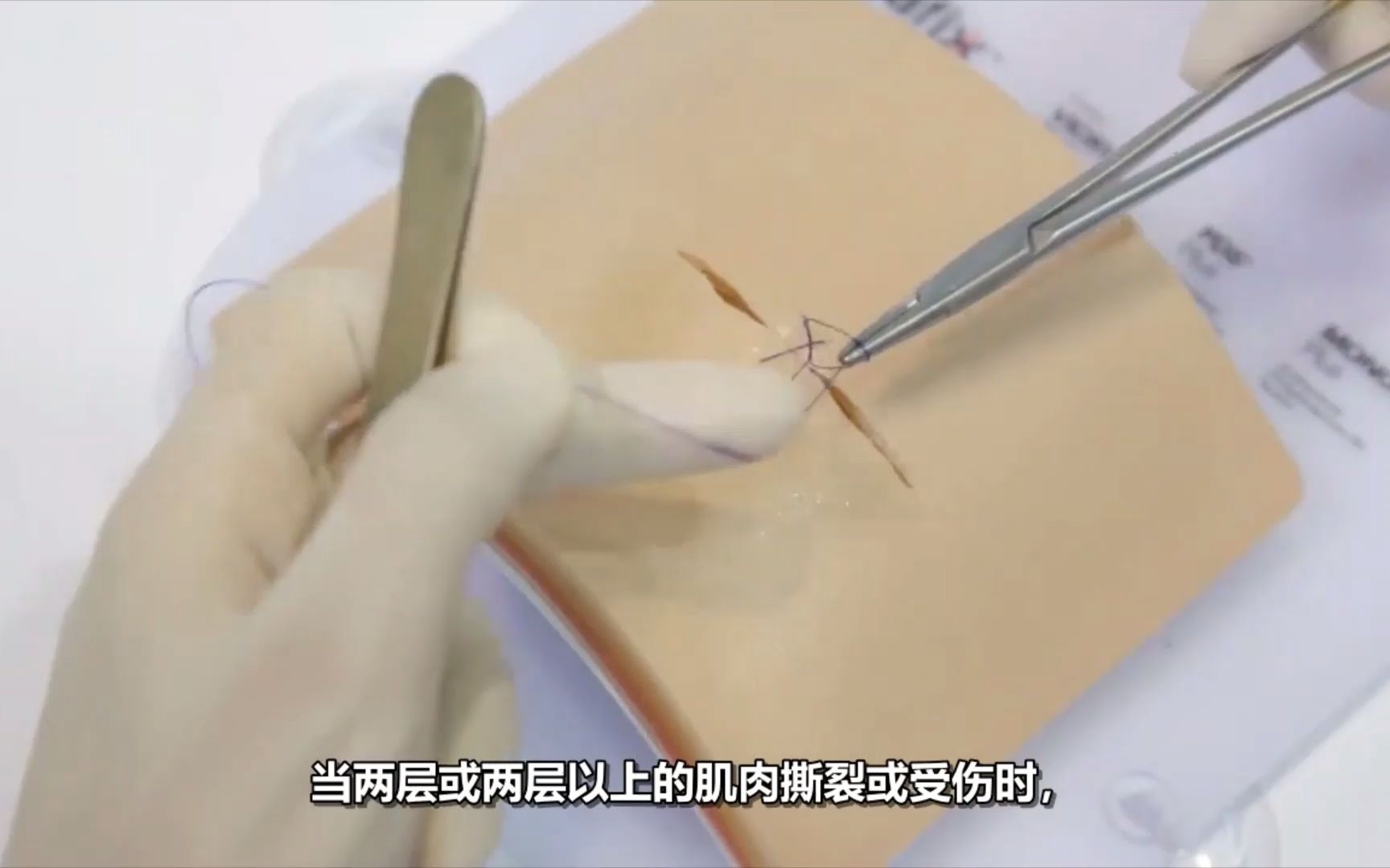 8字缝合/双间断缝合