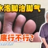 【皮肤科教授】盐水泡脚能治脚气？脚气到底怎么治？