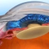 3D动画：白内障手术过程，了不起的现代医学科技