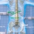支具治疗的原理是什么矫正脊柱侧凸的理论依据包括额面“三点力系统”、局部“力对系统”和矢状面脊柱平衡“三点力系统”指处于同