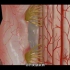 做脊髓手术为什么会瘫痪，脊髓肿瘤切除手术过程，3D演示。。