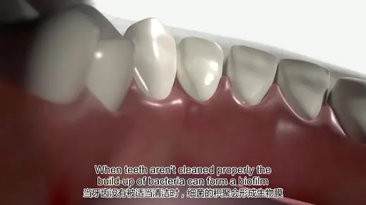 BioGaia Prodentis介绍中英文字幕