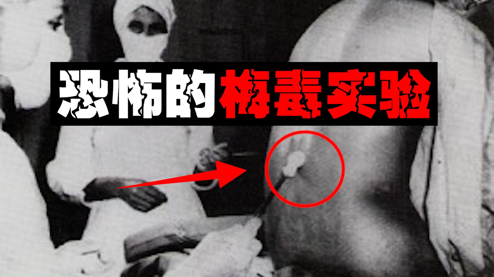 【烂死实验】600人被迫内脏融化五官溃烂，研究目的让人匪夷所思。。。