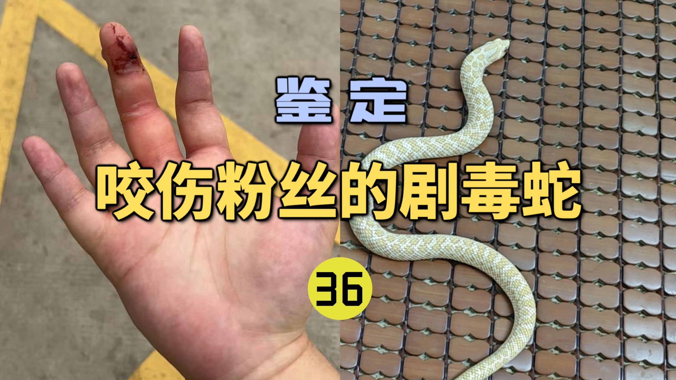 鉴定咬伤粉丝的毒蛇(36)粉丝被猪鼻蛇咬伤后肿成大猪蹄子？猪鼻蛇的毒性有多强？